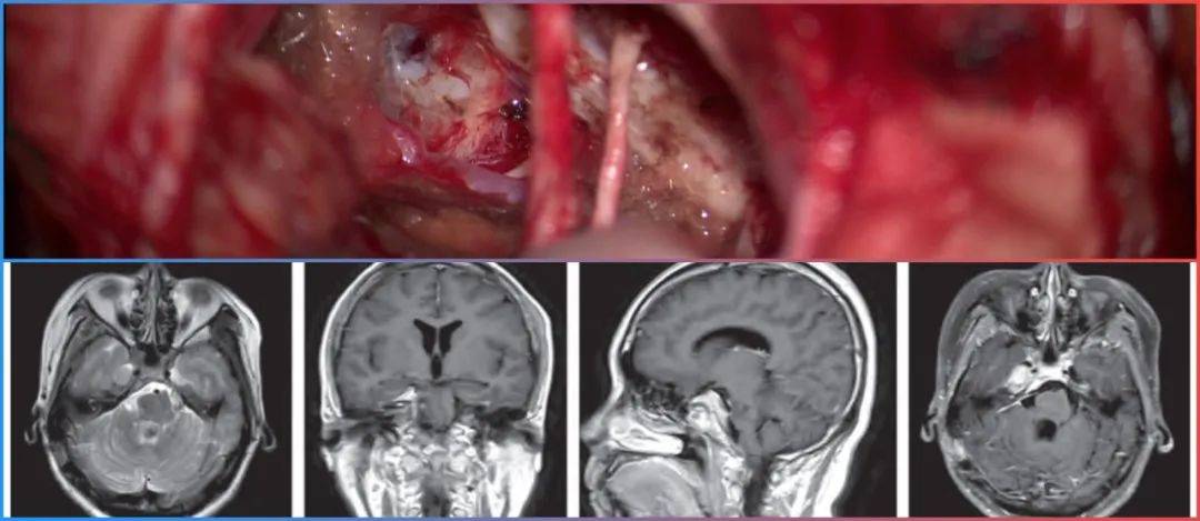 有坂深雪酒醉中文字幕