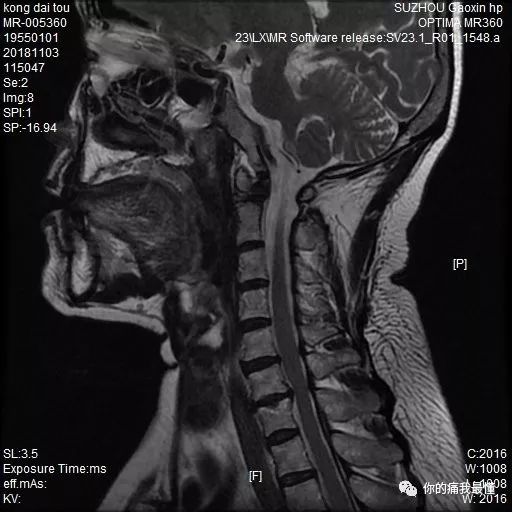 尖叫 如果你想表达“尖叫”