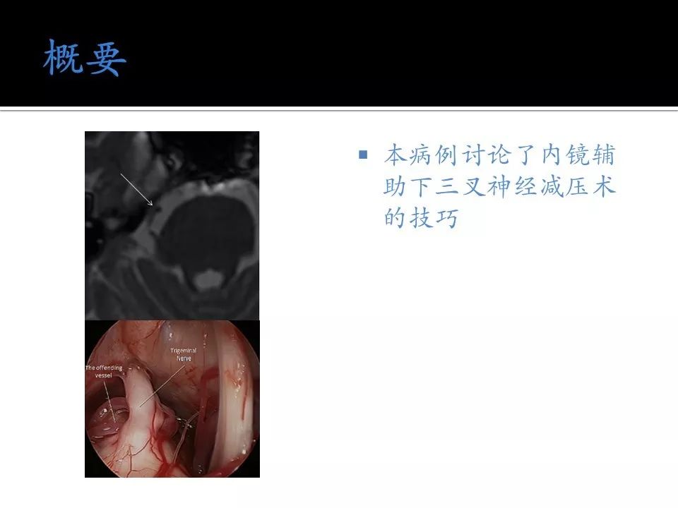 在线亚洲欧美日韩精品专区