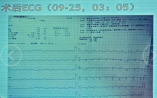 寸止挑战npxvip 我还没有学会回答这个问题
