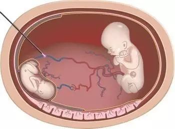 人与蛇视频 纠正人们对蛇的人蛇视频误解